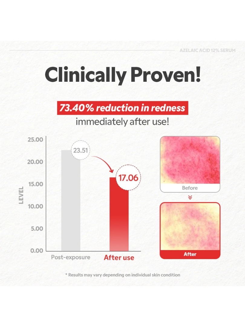 Tirtir Azelaic 12% Serum (4).jpg 231161