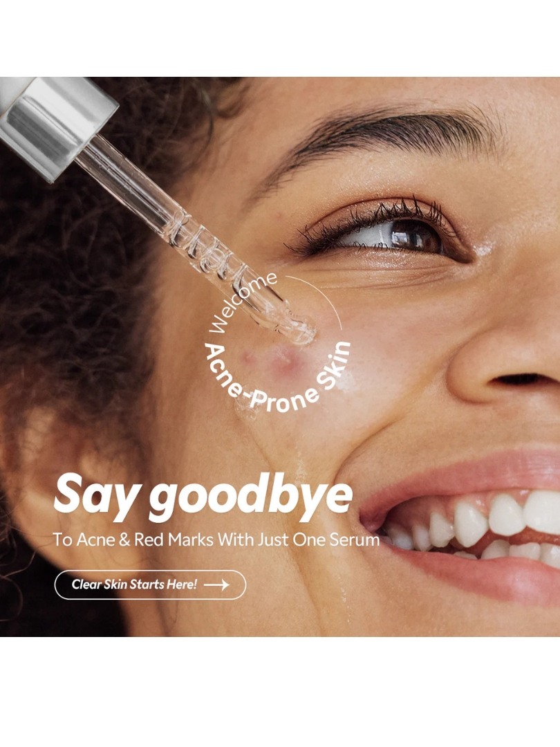 Tirtir Azelaic 12% Serum (6).jpg 231159